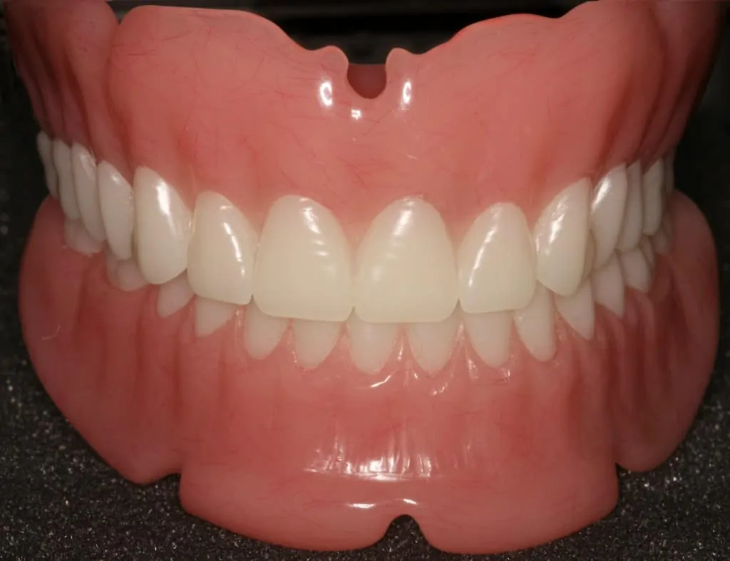 Dentures